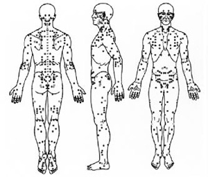 bruce lee pressure points